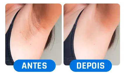 Antes e depois: axila